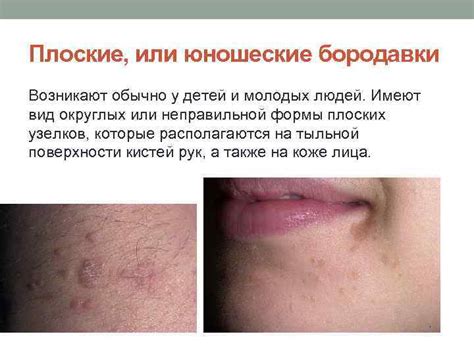 ПРЕЗЕНТАЦИЯ ПО БОРОДАВКАМ Студентка группы 02 -2 ПЭ