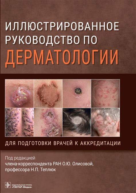 Книги по дерматовенерологии, книги для дерматологов – Медкнигасервис