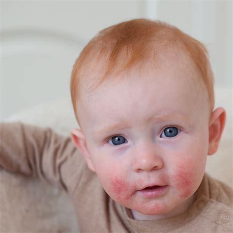 Probiotica voor je baby: helpen ze?