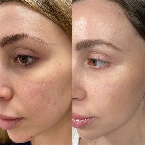 Gallery | South Florida | Advanced Eye Care of South Florida