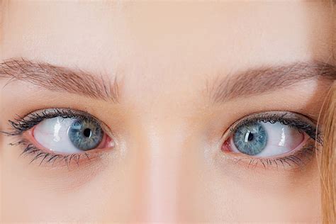 Strabismus - LASIK Eye Surgery Grand Junction | Cataracts Grand ...