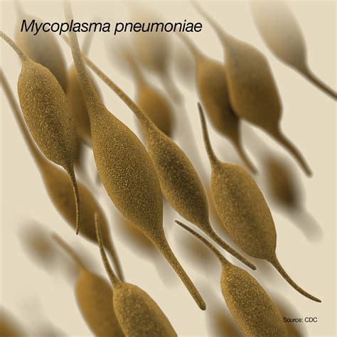 Mycoplasma Pneumoniae Erythema Multiforme Major (EMM) Associated With