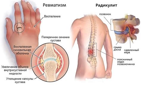 Дип Рилиф. Инструкция и показания по применению. Цена. Аналоги. Отзывы
