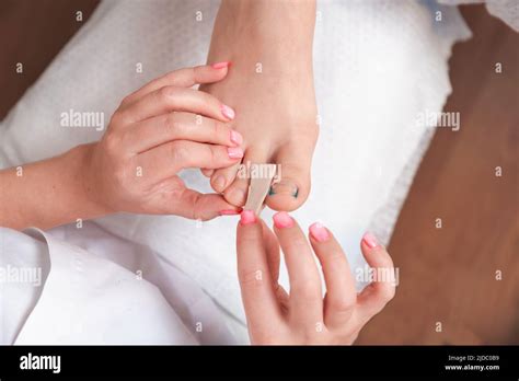 how to fix ingrown nail