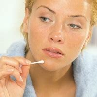 Салициловая кислота косметическая, Salicylic acid