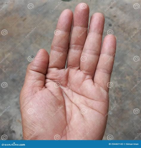 The Hand Has Two Definitions the Broad Definition is the Limb from the