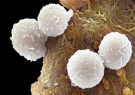 danish researchers show feasibility  stopping specialist follow