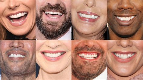 The High-Tech Hollywood Smile: How 3D Scanners And Artificial ...