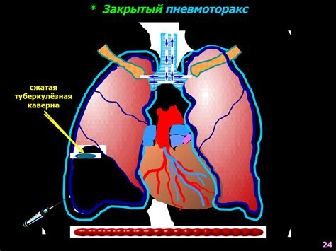 Неотложные состояния в пульмонологии - презентация онлайн