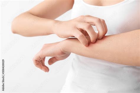 Young woman scratching her skin on light background Stock Photo | Adobe ...