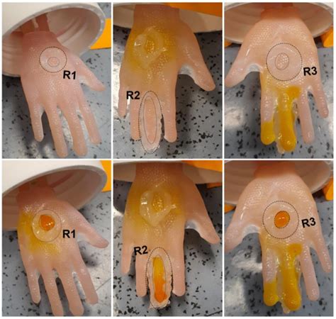 3D Artificial Skin Grafts Work Like “Biological Clothing” For Complex ...