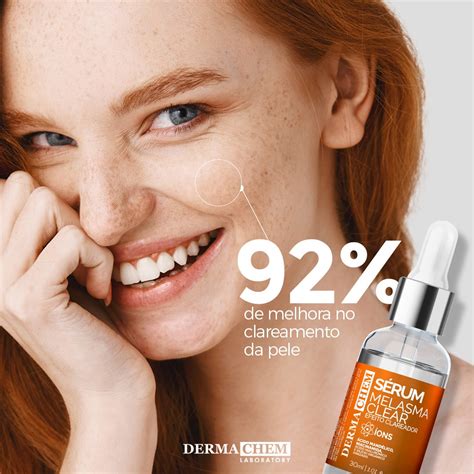Serum Clareador Dermachem É Bom - Sérum Facial Clareador De Manchas Melasma Dermachem 30 Ml | MercadoLivre