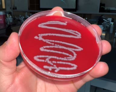 Solved Hello, I'm having trouble identifying this bacteria | Chegg.com 
