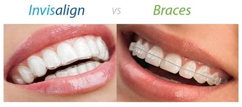 invisalign cost  melbourne care family dental