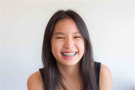 Orthodontia: MedlinePlus