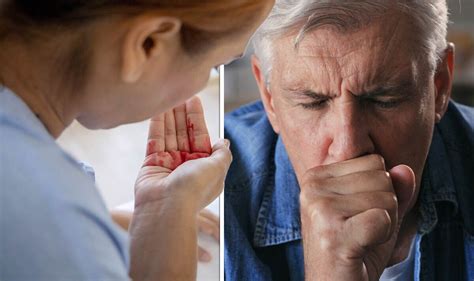 Lung cancer symptoms: What does a lung cancer cough sound like? Key ...