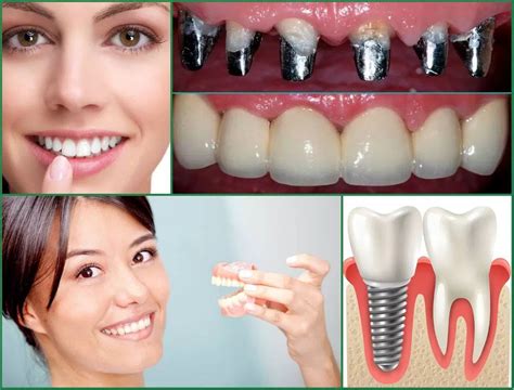 installation  dental implants  bali   place implants