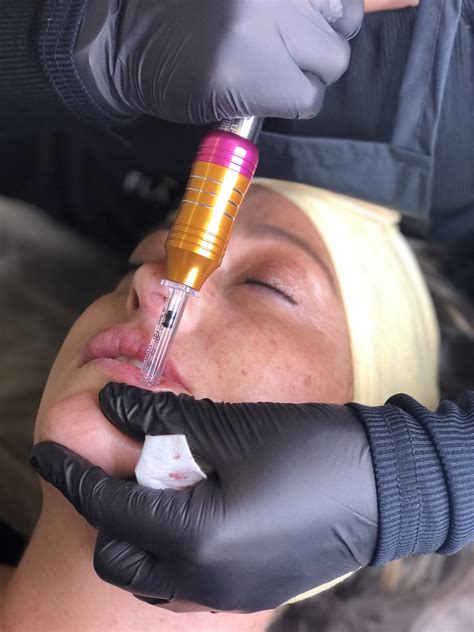 No Needle Lip & Lines Filler Manual - Luxx International Cosmetics Academy