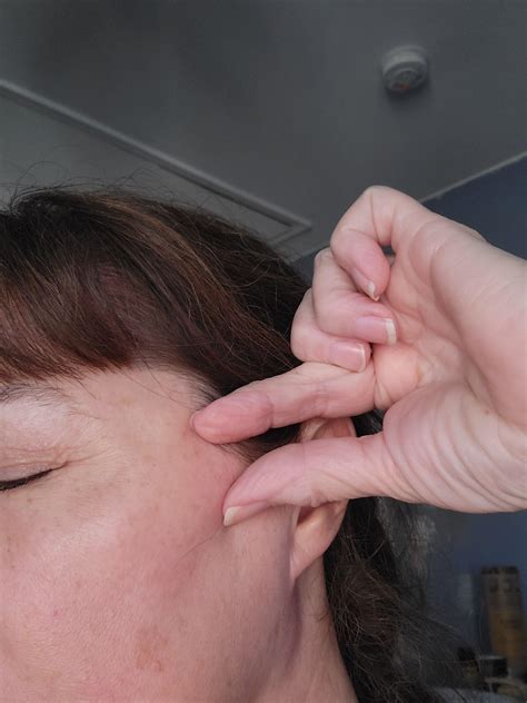 Jaw Cheekbone Pain What Is Jaw Pain? What Causes Jaw Pain? | Üsküdar