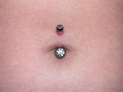 got my belly button pierced 5 days ago, is this a regular irritation