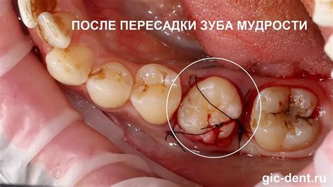 Немецкий Имплантологический Центр – Немецкая стоматология в Москве на ...