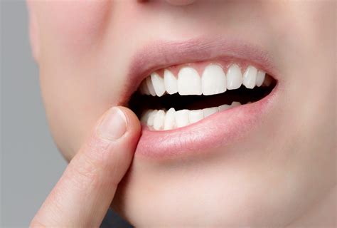 Fillings Come Out? | Midland & Oasis