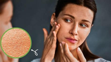 cual es la diferencia de la piel seca  la piel deshidratada