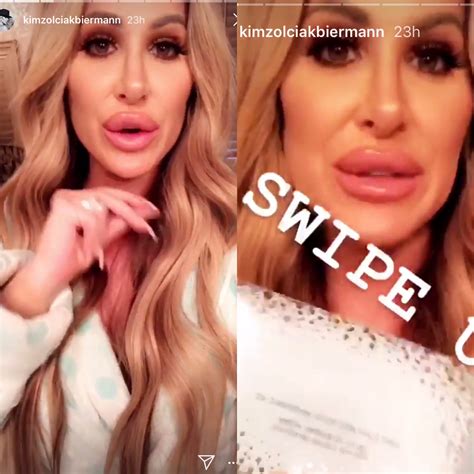 PHOTOS: RHOA's Kim Zolciak Trolled by Fans After Debuting Huge Lips!