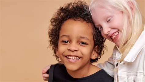 Albinism and Vision: Unraveling the Myths and Understanding the Facts ...