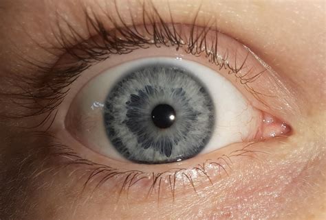 eye reveal  based   post rteenagers