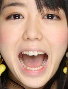 峯岸みなみさんの前歯や歯並び（ビーバー歯→歯列矯正スタート） - 僕の審美歯科ガイド｜前歯の差し歯治療で後悔しないための情報源