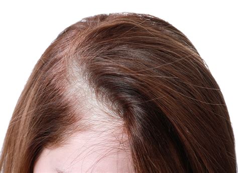 rich  thick hair