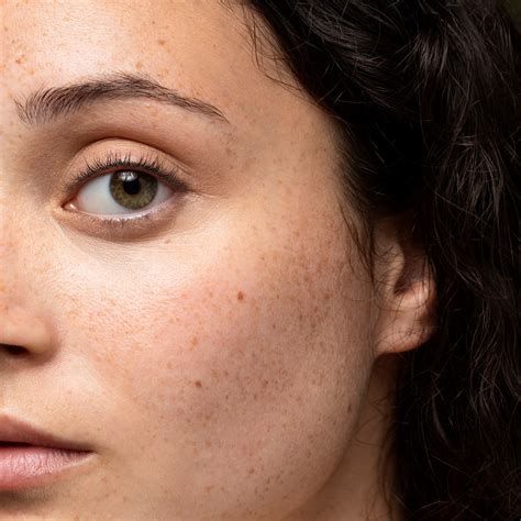 Why Do Black Spots Appear On Clothes at Bethany Lansell blog