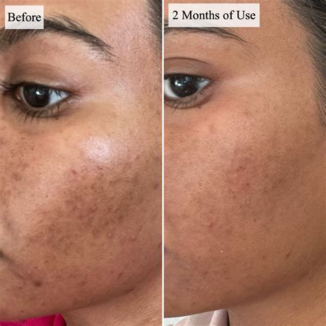 Caudalíe Vinoperfect Radiance Serum Review With Photos | POPSUGAR Beauty UK