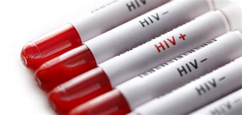 Hiv: 15mila italiani sieropositivi senza saperlo, 6mila in fase avanzata