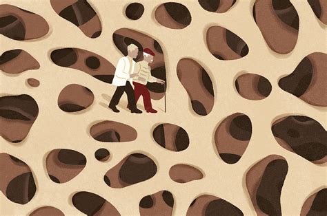 One Broken Bone? You May Be at Risk for Another - The New York Times