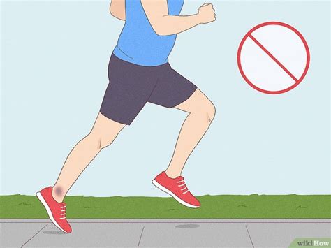 How to Heal a Bruise: First Aid & Remedies for Fast Healing