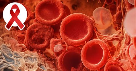 Myelodysplastic Syndrome Awareness