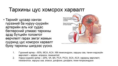 Тархины цочмог харвалт - online presentation