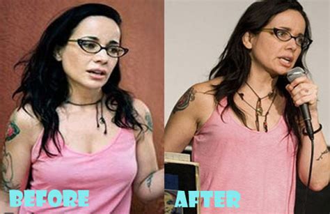 Janeane Garofalo Plastic Surgery Before and After - Lovely Surgery