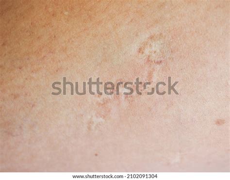 closeup scar skin texture background stock photo  shutterstock