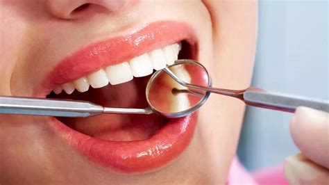 Dental Bonding for Chipped Teeth – Restore Your Smile with Affordable ...