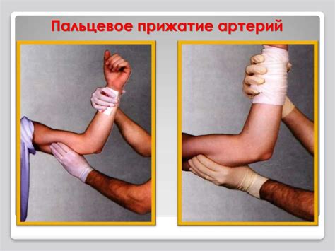 Первая помощь при кровотечениях - презентация онлайн