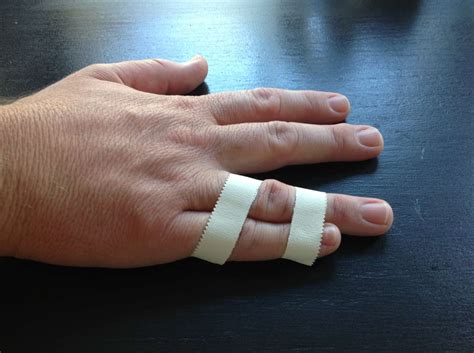 how to fix a broken pinky finger