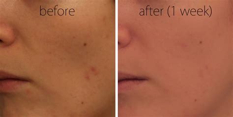 how long to steam face at home