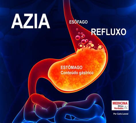 Como É Sentir Azia - Azia e indigestão: causas, sintomas e tratamento | Medicina - Mitos e ...