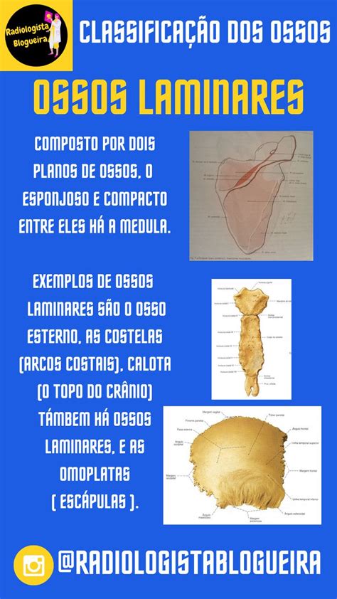 Ossos Laminares | Radiologia, Técnico em radiologia, Anatomia do cérebro