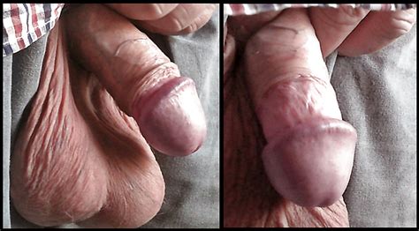 penis  foreskin remove porn pictures xxx  sex images