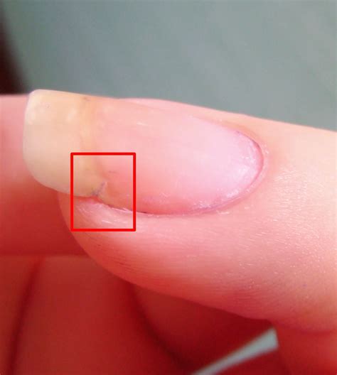 Konad Addict: How to fix a broken nail | Fix broken nail, Broken nails