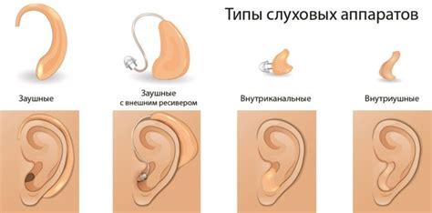 Лучшие слуховые аппараты, топ-10 рейтинг хороших слуховых аппаратов